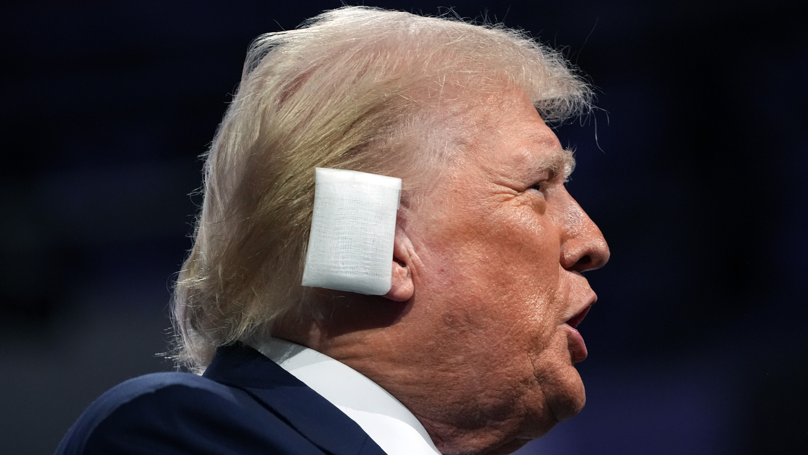 Could Donald Trump's Ear Injury Cause Lasting Damage? - Health Digest
