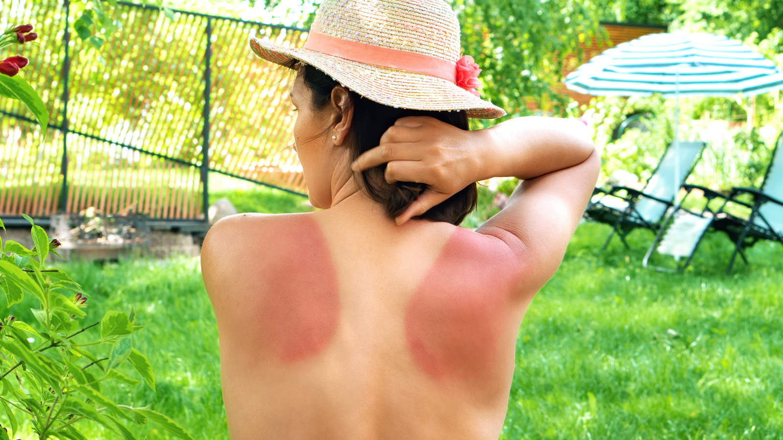 Should You Take Ibuprofen After Getting A Bad Sunburn? Here's What We Know - Health Digest